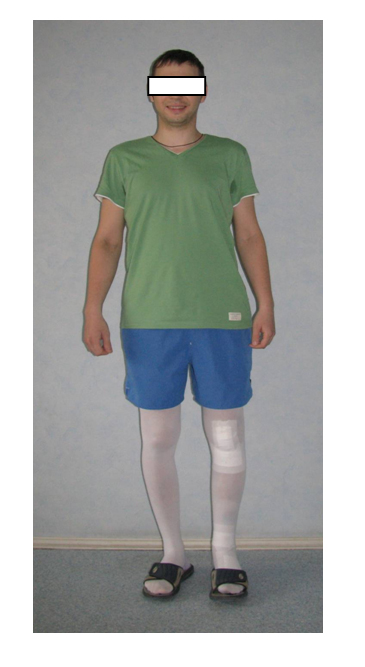 Внешний вид пациента спустя 3 недели