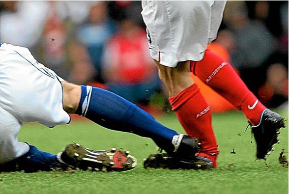 Переломы лодыжек - как это бывает