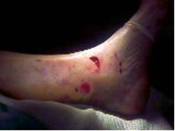 Рис. 5 (а) малоинвазивный доступ