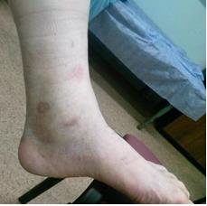 Рис. 6 (а) Результат через 6 недель после операции