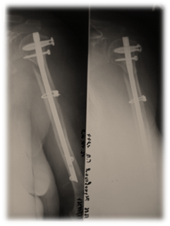 Рис.1. После операции