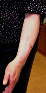 Рис. 8-в. Результат после операции