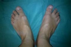 Результат после операции