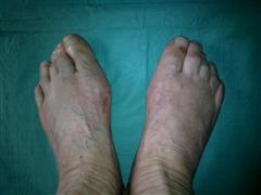 Результат после операции