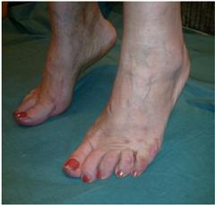 Результат после операции