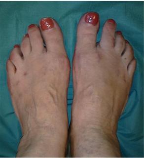 Результат после операции