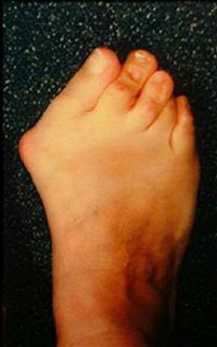 Результаты после операции