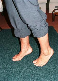 Результаты после операции