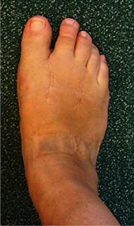 Результаты после операции